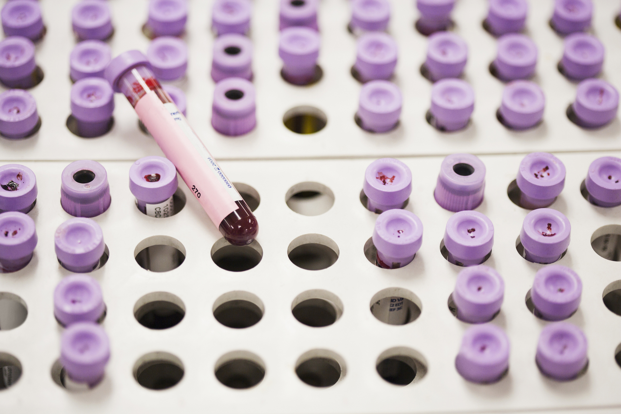 purple cap, blood tube samples on tray