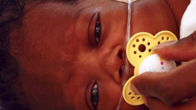Baby with breathing tubes in ICU