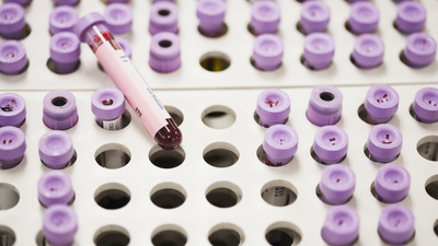 purple cap, blood tube samples on tray